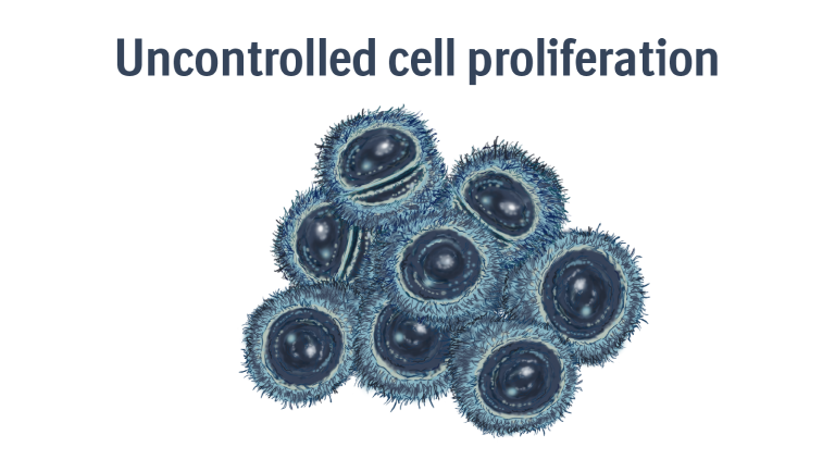 Diagram showing excess MDM2 disrupting p53, the guardian of the genome, leading to uncontrolled cell proliferation in Dedifferentiated liposarcoma (DDLPS Cancer).