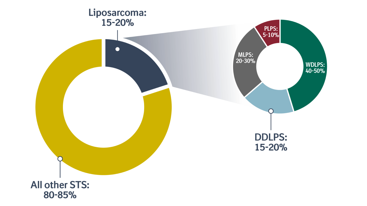 Charts showing the estimated proportion of liposarcoma in STS is 15-20%, and among liposarcomas, DDLPS represents 15-20% of diagnosed cases.