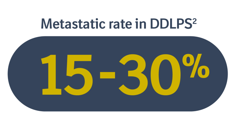 Graphic showing the metastatic rate in Dedifferentiated Liposarcoma (DDLPS Cancer) at 15 - 30%